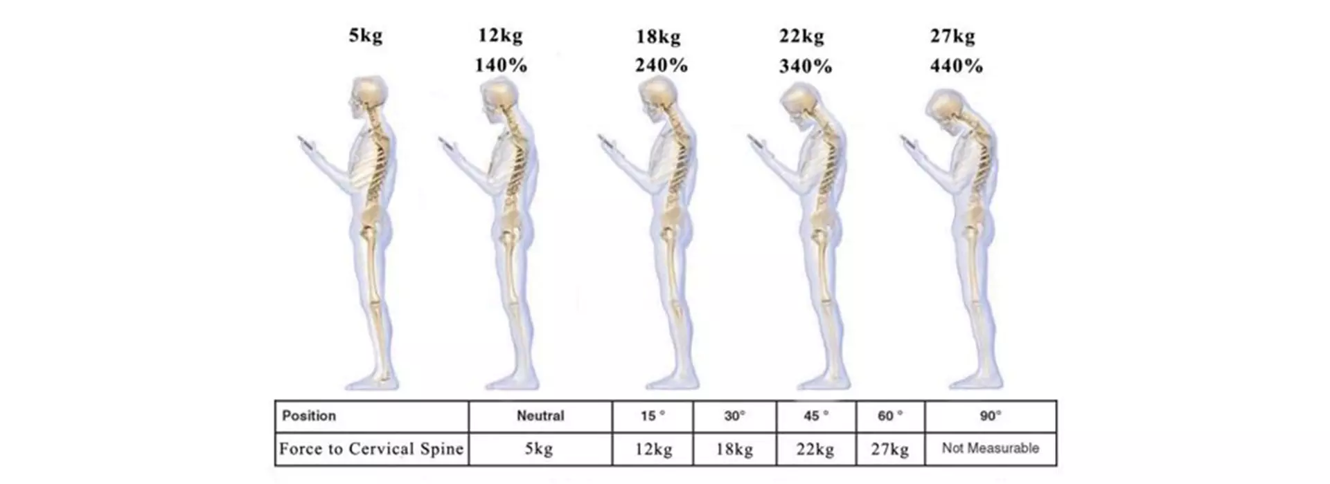 disegno di 5 scheletri con le varie posture, percentuali di carico, kilogrammi e gradi di inclinazione del capo per spiegare leva muscolare svantaggiosa per contrastare la gravità cervicale ciclismo