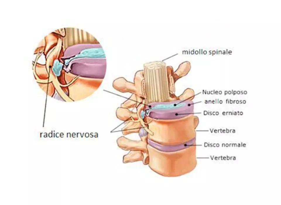 il disegno della sezione della colonna vertebrale per l'articolo sul mal di schiena in bici di Boeris Bikes Torino